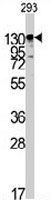 PAB3525 - Isoleucyl-tRNA synthetase / IARS2