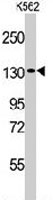 PAB3528 - VARS (Valyl-tRNA synthetase)