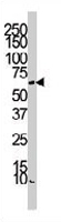 PAB3530 - Aurora kinase A