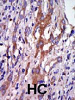 PAB3530 - Aurora kinase A