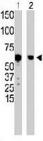 PAB3531 - Glucokinase / Hexokinase-4