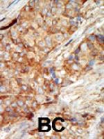 PAB3531 - Glucokinase / Hexokinase-4