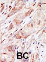PAB3532 - Glucokinase / Hexokinase-4