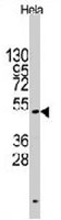 PAB3534 - CD4