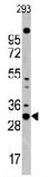 PAB3536 - CDK1