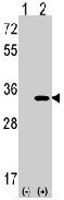 PAB3536 - CDK1