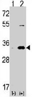 PAB3537 - CDK1