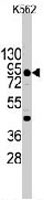 PAB3539 - Cadherin-3
