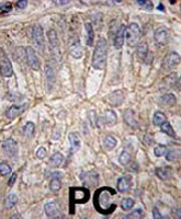 PAB3539 - Cadherin-3