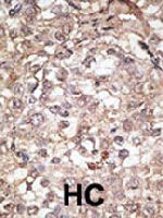 PAB3541 - CD281 / TLR1