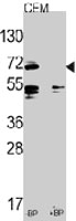 PAB3544 - CD282 / TLR2