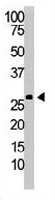 PAB3569 - Dickkopf-2 (DKK2)