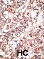 PAB3569 - Dickkopf-2 (DKK2)