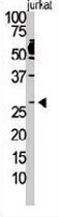 PAB3570 - Dickkopf-2 (DKK2)