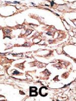 PAB3570 - Dickkopf-2 (DKK2)
