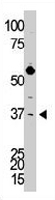 PAB3571 - Dickkopf-3 (DKK3)