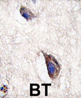 PAB3571 - Dickkopf-3 (DKK3)