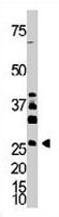 PAB3573 - Dickkopf-4 (DKK4)