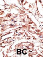 PAB3573 - Dickkopf-4 (DKK4)
