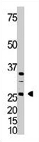 PAB3574 - Dickkopf-4 (DKK4)