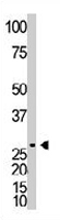 PAB3576 - Dickkopf-like protein 1