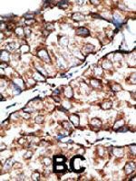 PAB3576 - Dickkopf-like protein 1
