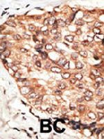 PAB3577 - STAT5B