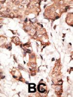 PAB3578 - STAT2