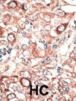 PAB3582 - GJB2 / Cx26