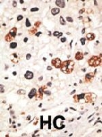 PAB3584 - GJB3 / Cx31