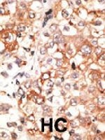PAB3593 - GJC1 / Cx45