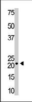PAB3604 - Visinin-like protein 1 / HLP3