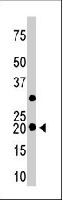 PAB3605 - Hippocalcin-like protein 1 (HPCAL1)
