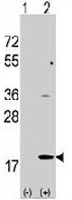 PAB3605 - Hippocalcin-like protein 1 (HPCAL1)