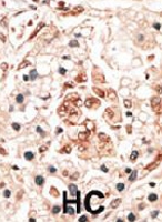 PAB3607 - HPCA / Hippocalcin