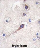 PAB3607 - HPCA / Hippocalcin