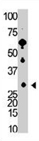 PAB3609 - Recoverin