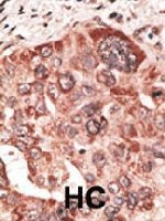 PAB3609 - Recoverin