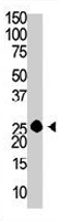 PAB3612 - GCAP1 / GUCA1A