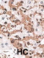 PAB3618 - Calsenilin