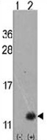 PAB3628 - URM1