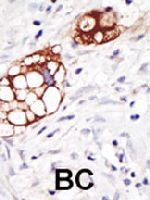 PAB3656 - mGluR6 / GRM6