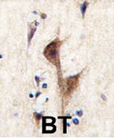 PAB3659 - Histamine H3 receptor