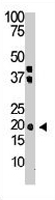 PAB3664 - Interleukin-28A / IL28A