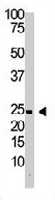 PAB3666 - Interleukin-29 / IL29