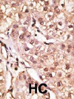 PAB3666 - Interleukin-29 / IL29