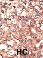 PAB3674 - BMP5
