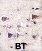 PAB3678 - PDGFA