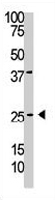 PAB3679 - PDGFB