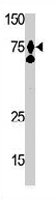 PAB3683 - Hepatocyte growth factor / HGF